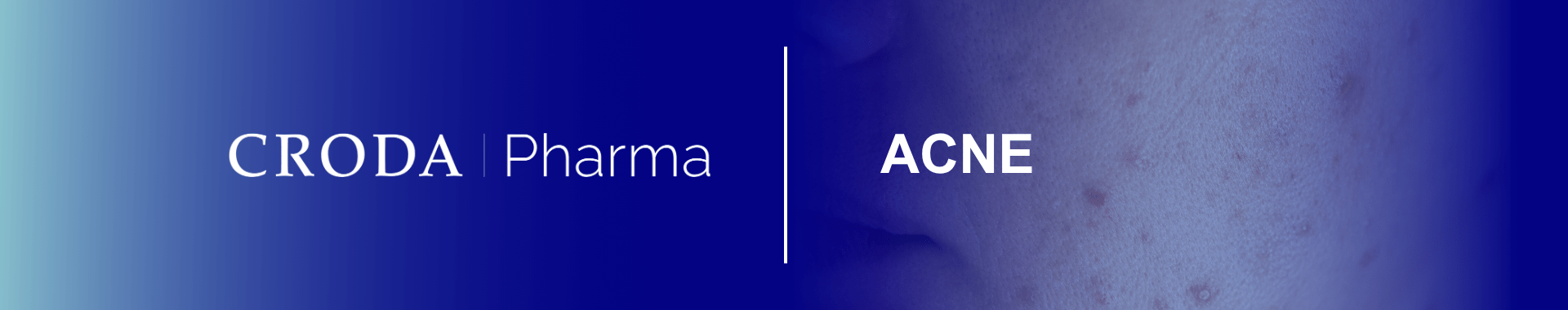 Formulating acne products requires light, non-occlusive ingredients to soothe inflamed skin, optimise the performance of anti-acne actives and encourage repeat use of the product.