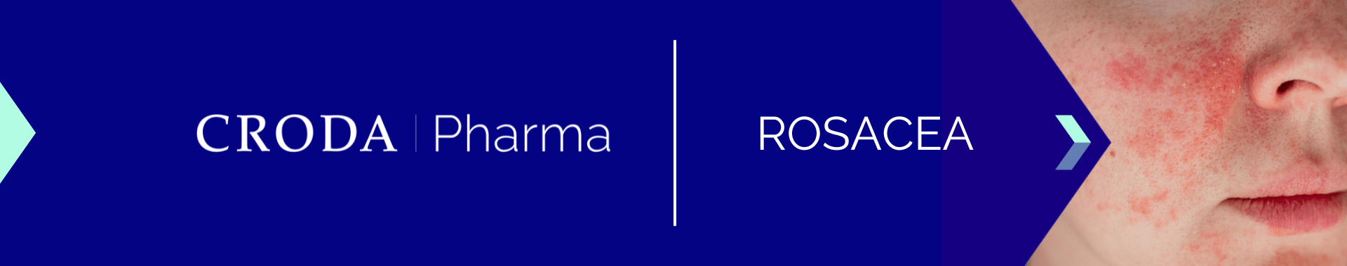Explore excipients from Croda Pharma to meet rosacea treatment needs