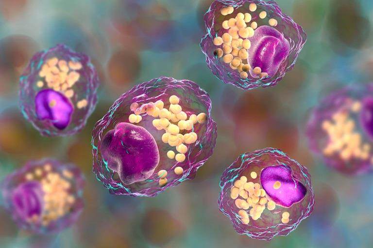 Foam cell, macrophage cells that contain lipid droplets and are components of atherosclerotic plaque