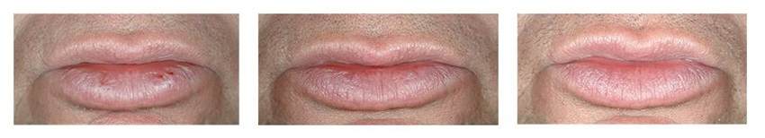 Efectos de la lanolina en los labios