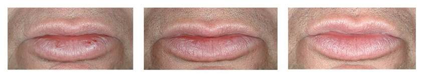  Efeitos da lanolina nos lábios
